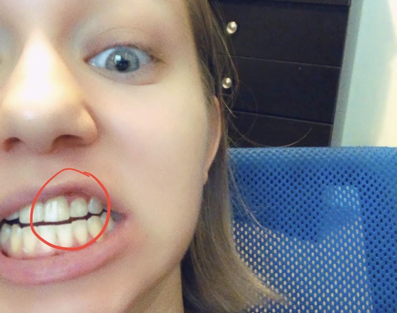 Douglas B Hunt D.D.S image 3