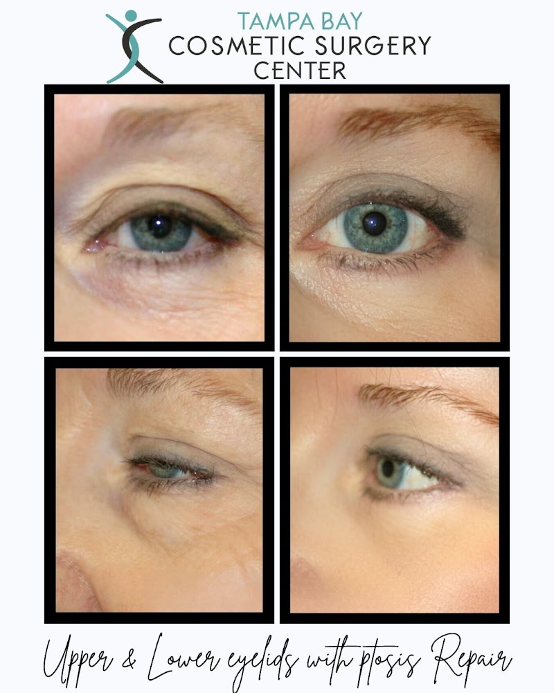 Tampa Bay Cosmetic Surgery Center image 1